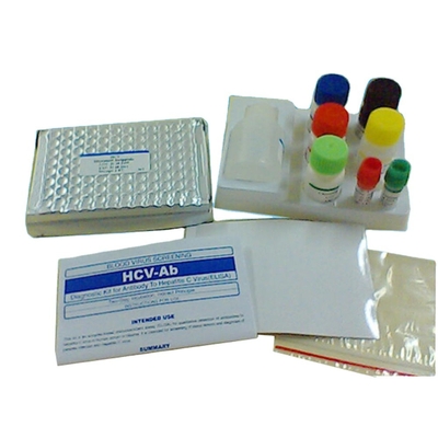 मेडिकल डायग्नोस्टिक्स HBsAb एलिसा टेस्ट अभिकर्मकों OEM पैकिंग: